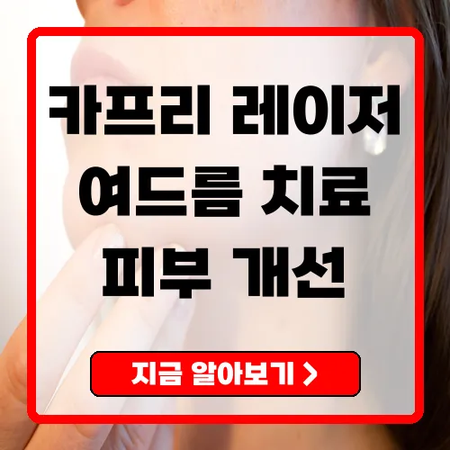 카프리레이저 여드름 관리의 혁신적 솔루션