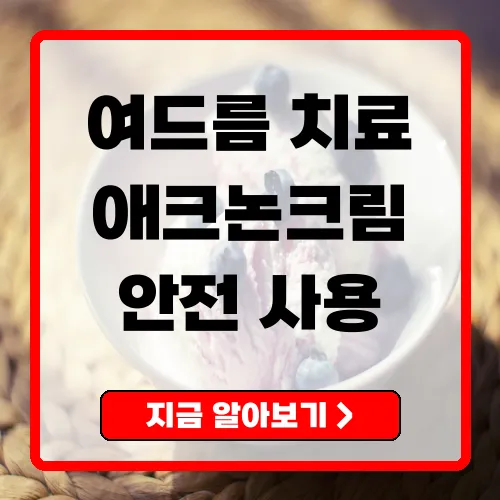 애크논크림 효과적으로 사용하는 방법과 주의사항