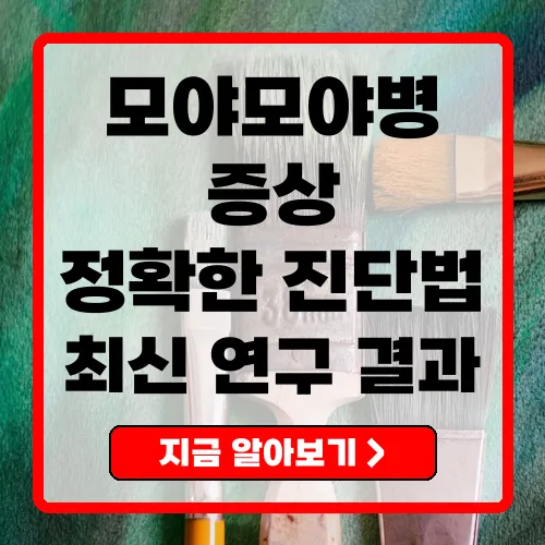 모야모야병 증상부터 진단, 최신 연구까지 완벽 정리