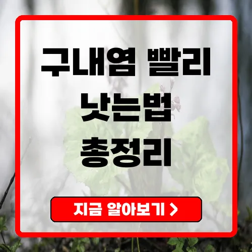 구내염 빨리 낫는 법 완전정리