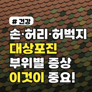 손·허리·허벅지 대상포진, 부위별 통증과 증상에 따라 ‘이것’ 달라집니다.