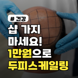 샵 가지 마세요! 1인당 1만원으로 두피스케일링 집에서 끝내는 법