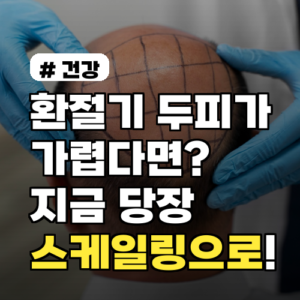 환절기 두피가 가렵다면? 지금 당장 해야 할 스케일링으로 해결!